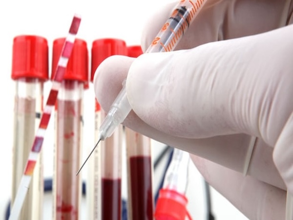 Suicide Prediction Blood Test