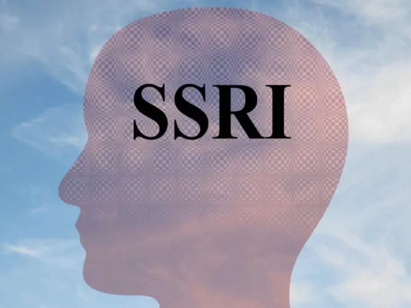 SSRi's Antidepressants