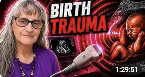 Birth Trauma