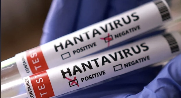 Hanta Virus