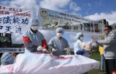 Organ harvesting