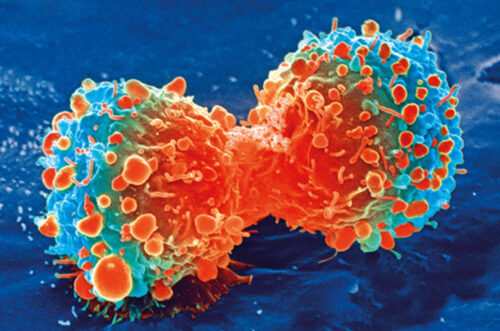 Cancer inewparadigm - About Cancer